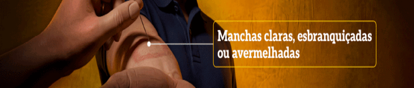 PI 89041 AL CAMPANHA HANSENÍASE DIAS 09 A 26 DE ABRIL